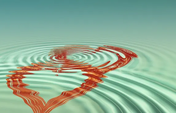 Casino High Bet Soporte